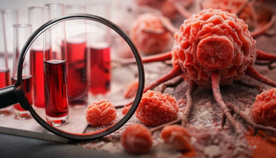 赤ワインとがんリスク